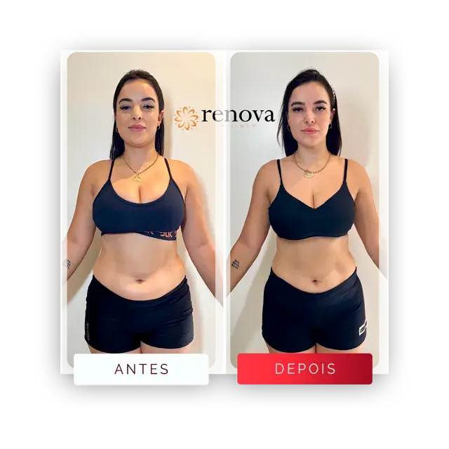 Antes e depois — cliente 1