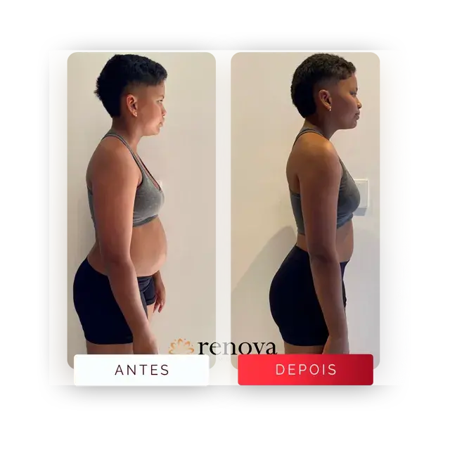 Antes e depois — cliente 7