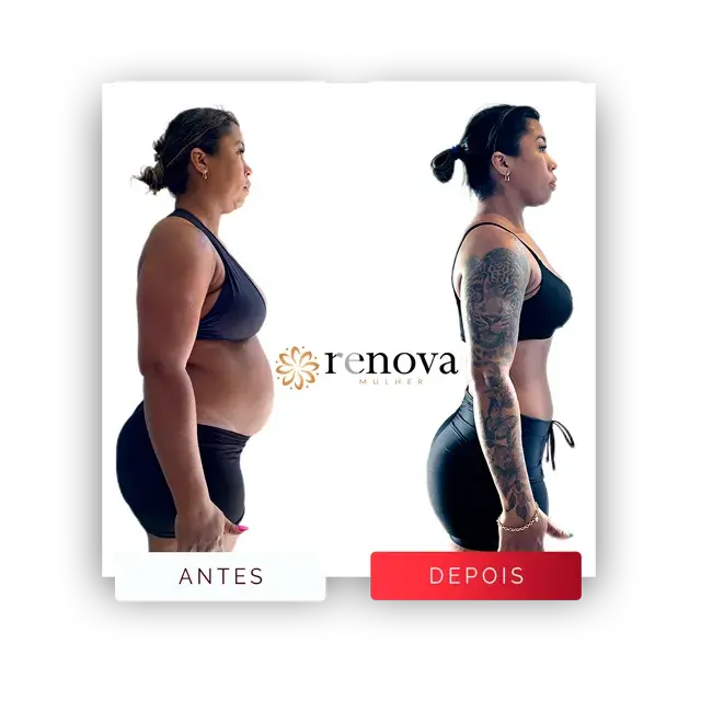 Antes e depois — cliente 8