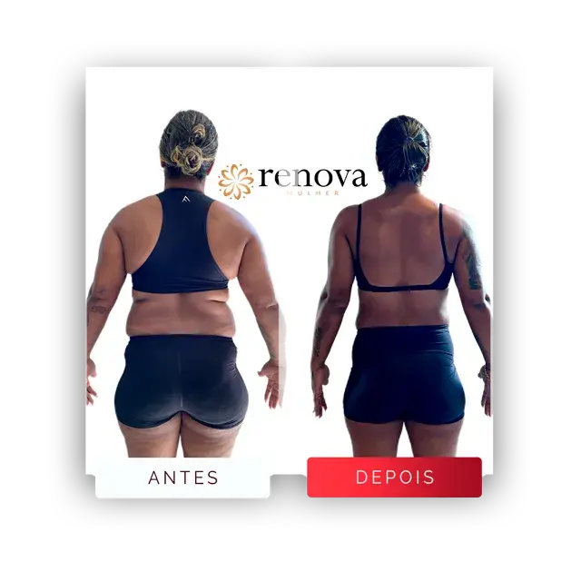 Antes e depois — cliente 9