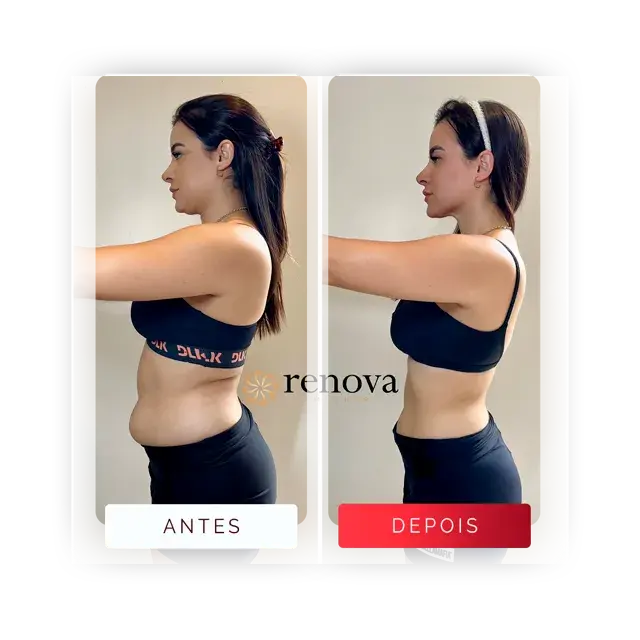 Antes e depois — cliente 2