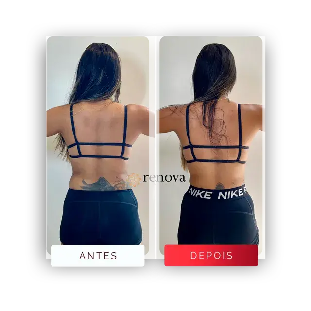 Antes e depois — cliente 3