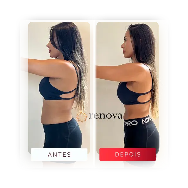 Antes e depois — cliente 4