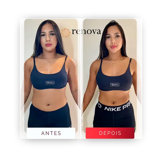 Antes e depois — cliente 6